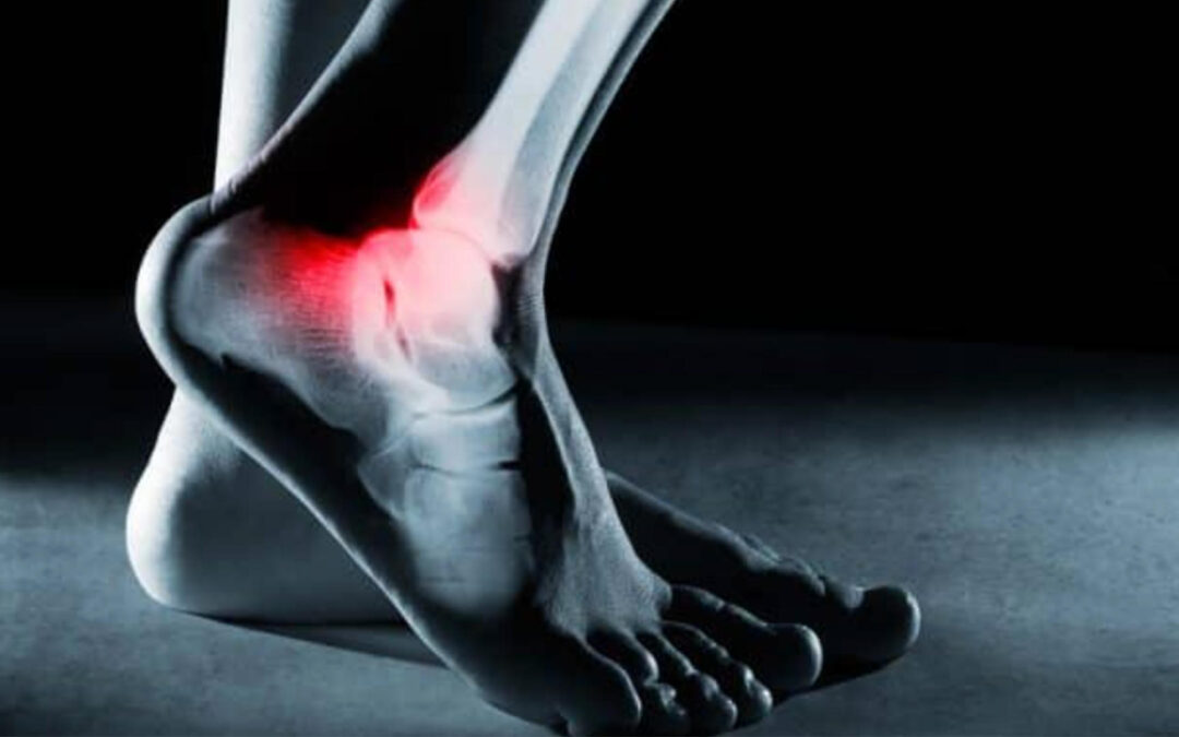 Trial Lawyers for Justice Wins Seven Figure Settlement For Pre-Death Pain Suffering Of Sioux City Man In Product Defect Foot Injury Case